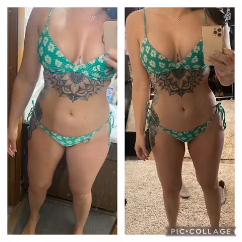 Before and after comparison showing full body weight loss and improved body contour in a woman wearing a green bikini