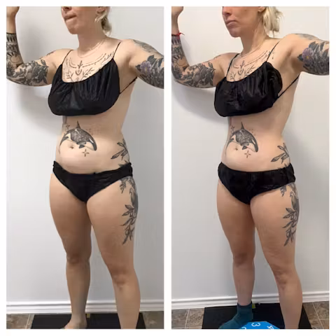 Before and after comparison showing body contour and weight loss results in a woman wearing black underwear