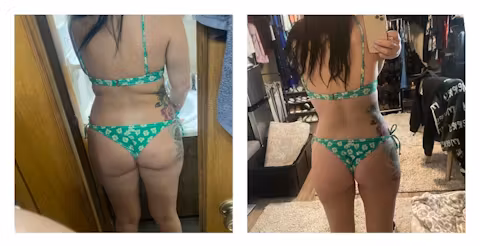 Before and after comparison showing body contour and weight loss results in a woman wearing green underwear